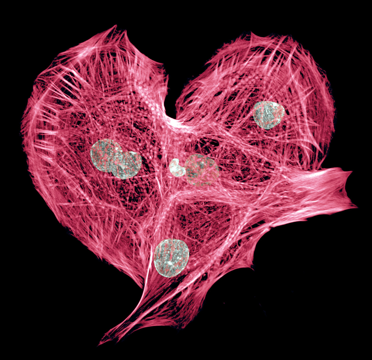 Paloheimo Cardiomyocytes Wiki