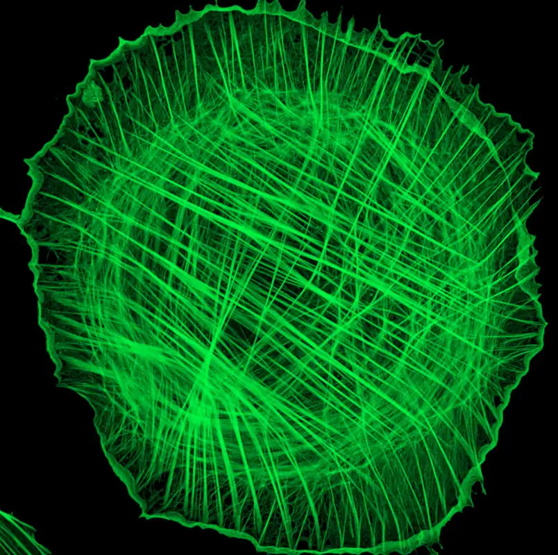 Image 2 PMEF Tm5NM1+2 KO Huygens Deconvolved. Contrast Enhanced Max Projection