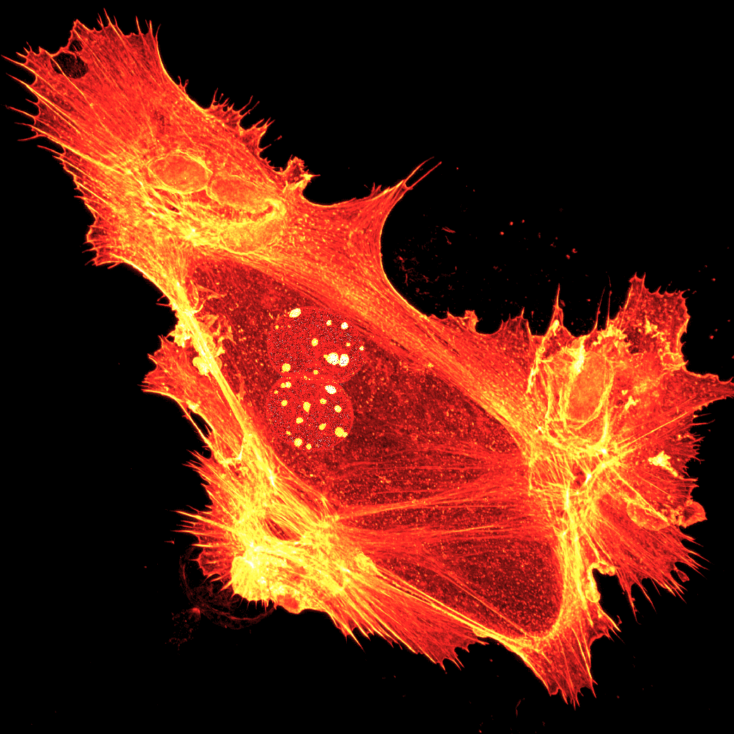 Fire   SVI Contest