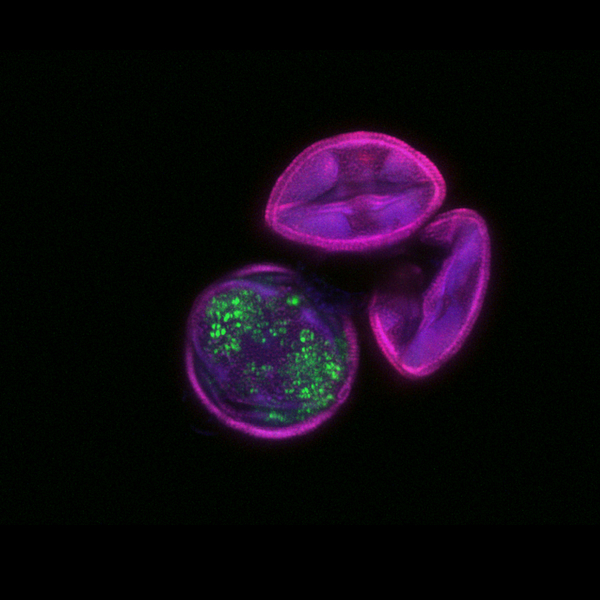 5th Entry   Pollen Grain Autofluorescence