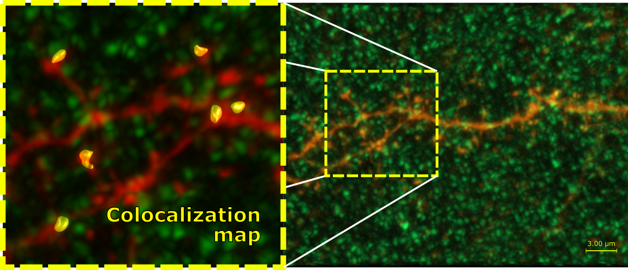 Coloc Analysis Neuron