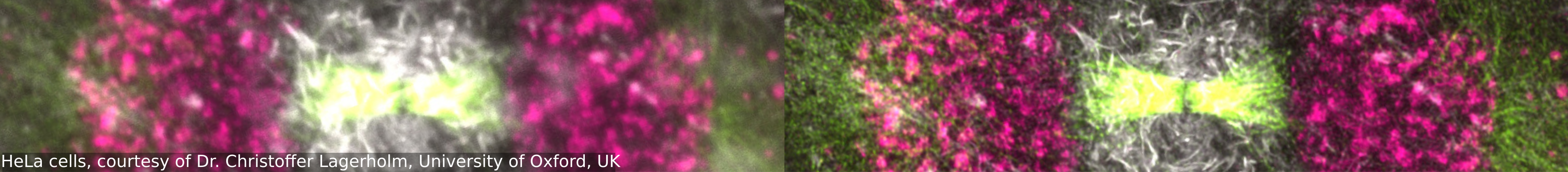 HeLa deconvolution