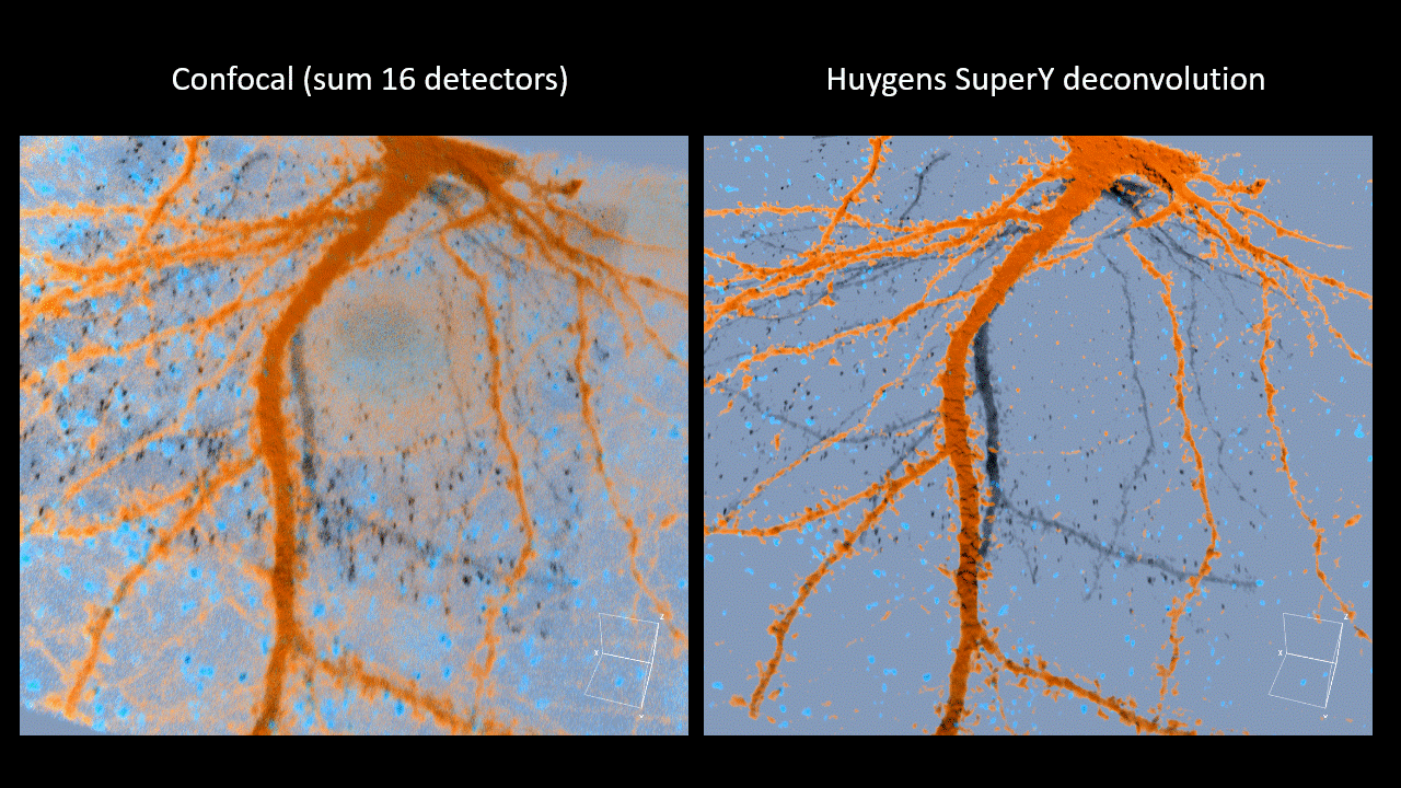 Neurons Large