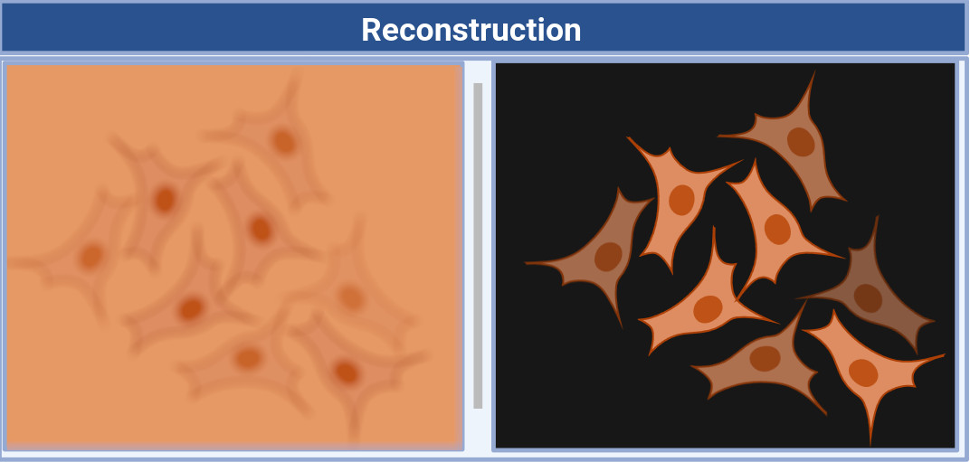 Reconstruction